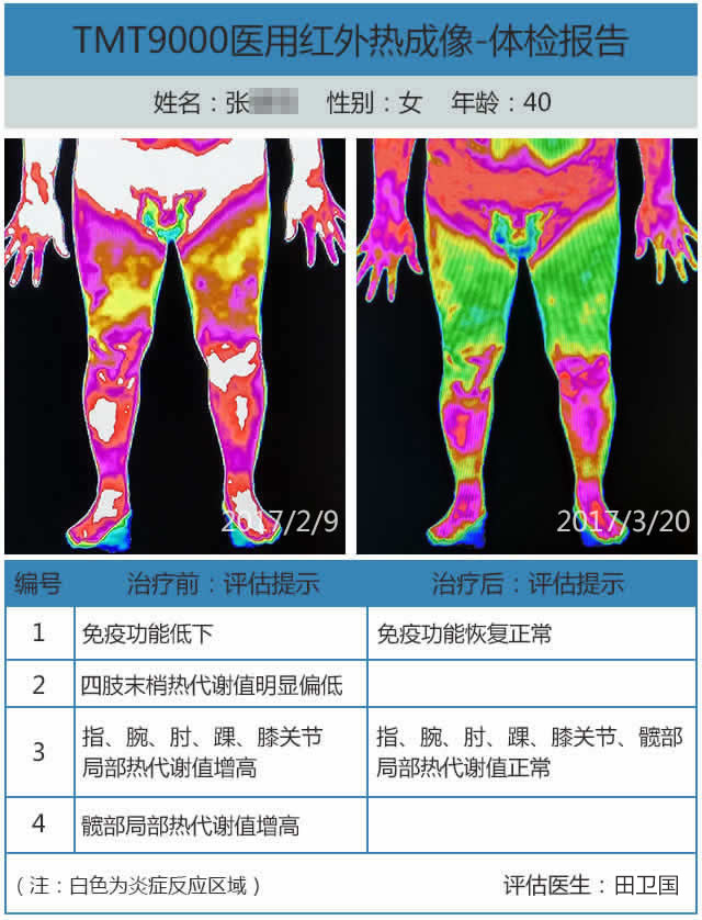 风湿表格.jpg