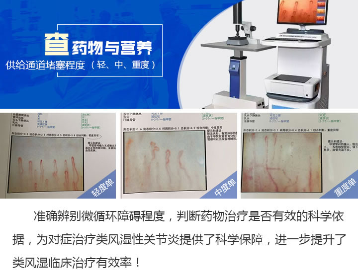 微循环.jpg