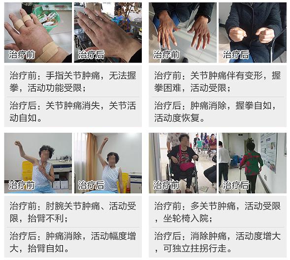前后对比.jpg