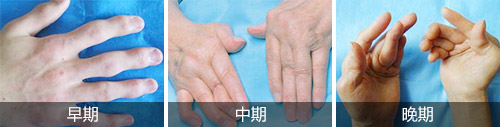 早中晚期.jpg