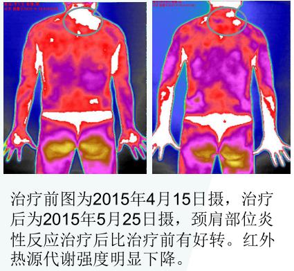 红外热仪3.jpg