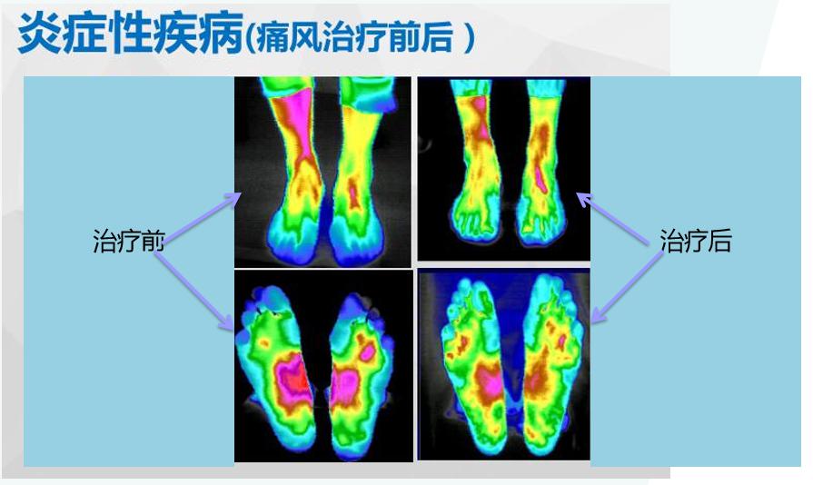 红外热仪7.jpg