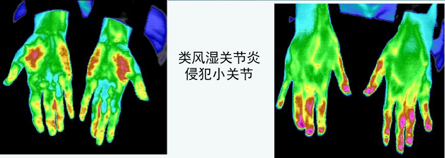 红外热仪0.jpg