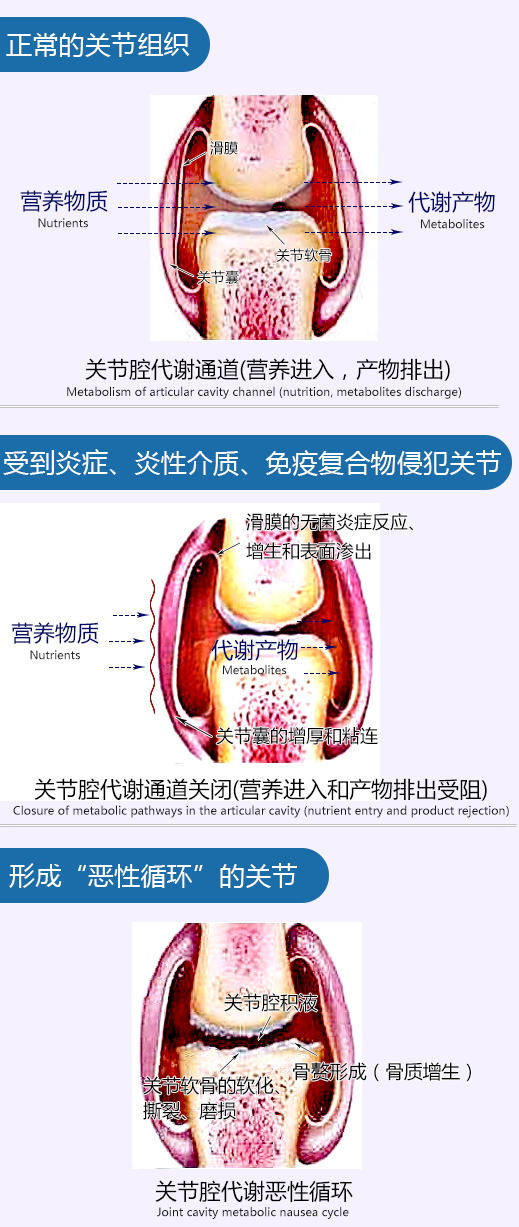 关节.jpg