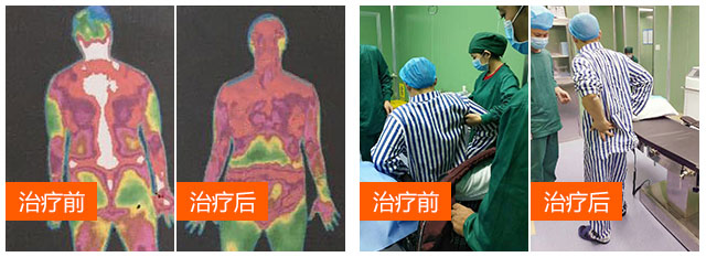 治疗前后03.jpg