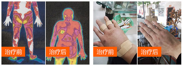治疗前后01.jpg