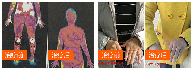 治疗前后02.jpg